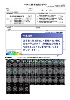 VSRAD