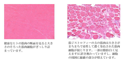 筋肉細胞
