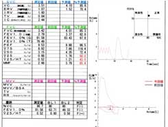呼吸機能検査の結果例