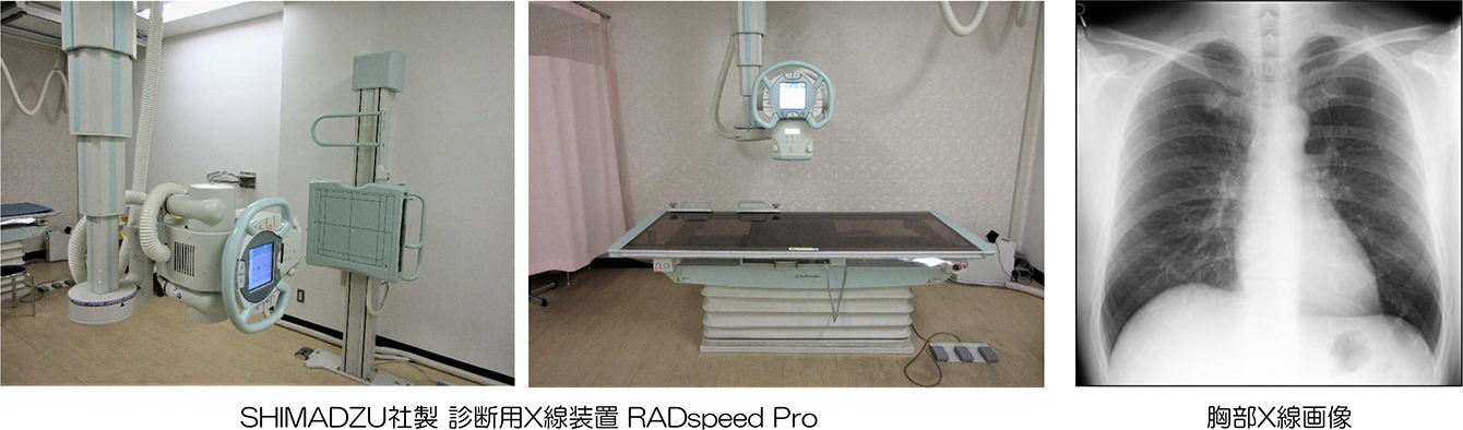 X線撮影検査